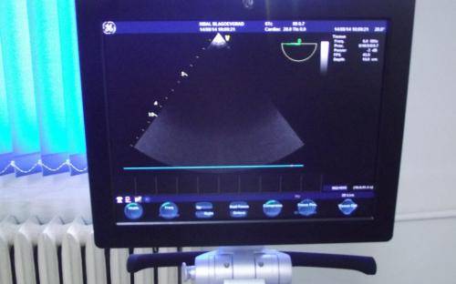 Кардиологично отделение с нова модерна апаратура